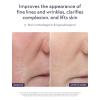 ALASTIN Skincare Restorative Skin Complex Anti-Aging Face Serum – Now with TriHex+ Technology (1 oz) | Improves Skin Hydration, Dullness, & Appearance of Fine Lines and Wrinkles(RSC 2)