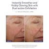 ALASTIN Skincare ReSURFACE Exfoliating Skin Polish (2.3 oz) | Face Scrub For Softer, Smoother Skin | With Glycolic Acid(ReSURFACE Exfoliating)